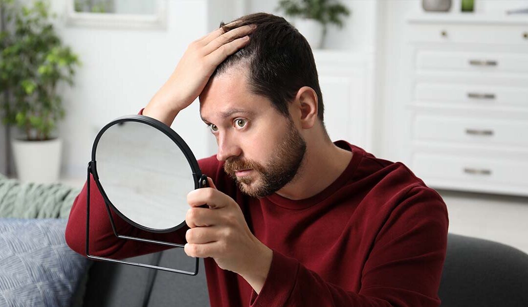 man with hair loss