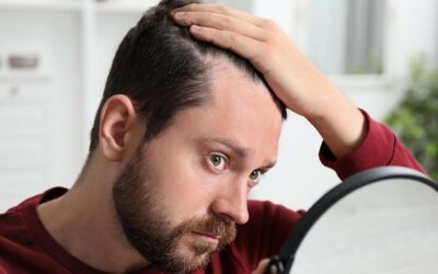 What Is Anagen Effluvium?