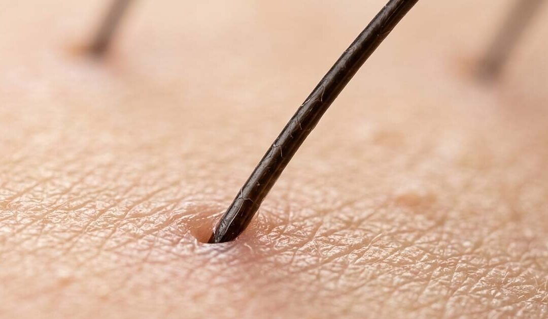 Close up of hair poking through the scalp.